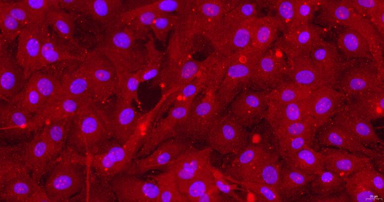 Primary Rat Endocardial Fibroblasts (EnCF)