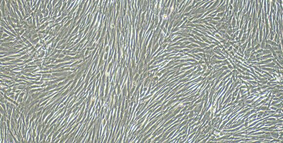 Primary Canine Epicardial Fibroblasts (EpCF)