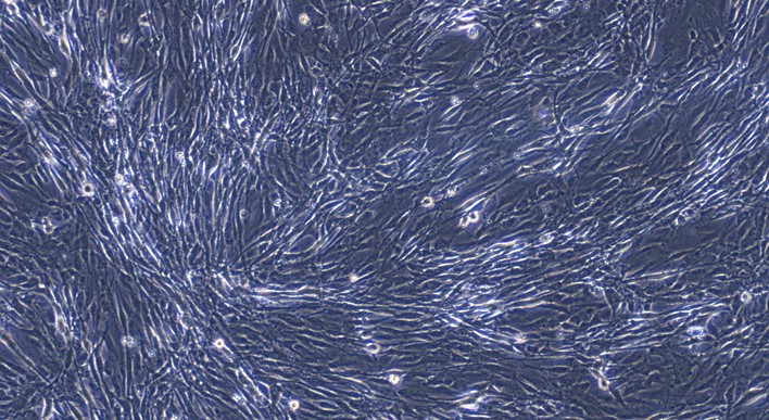 Primary Feline Aorta Adventitial Fibroblasts (AAF)