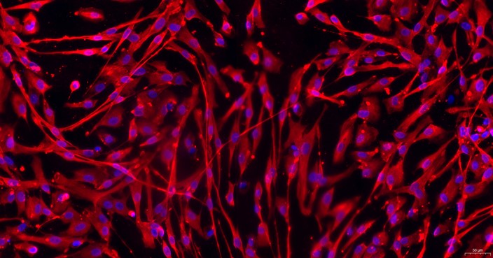 Primary Feline Aorta Adventitial Fibroblasts (AAF)