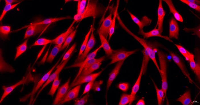 Primary Feline Aorta Adventitial Fibroblasts (AAF)