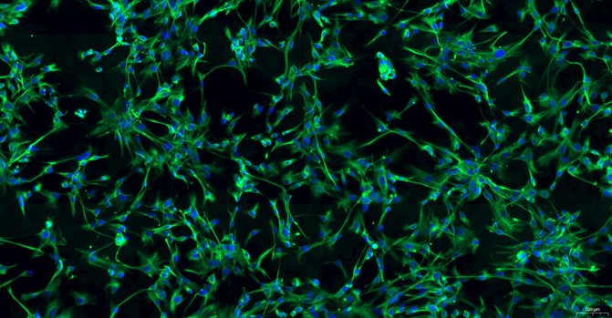 Primary Rabbit Aorta Adventitial Fibroblasts (AAF)