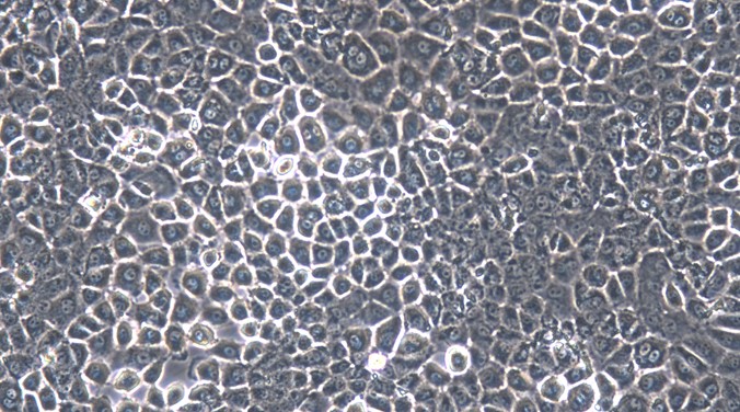 Primary Mouse Pleural Mesothelial Cells (PlMC)