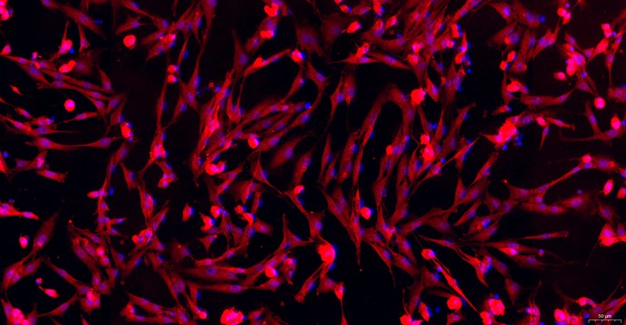 Primary Mouse Lingual Muscle Skeletal Muscle Cells (LMSMC)