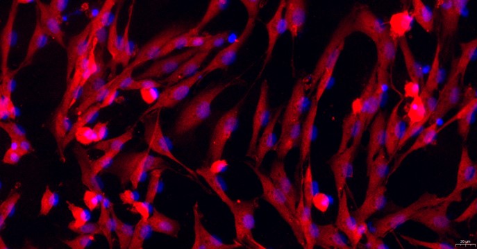 Primary Mouse Lingual Muscle Skeletal Muscle Cells (LMSMC)