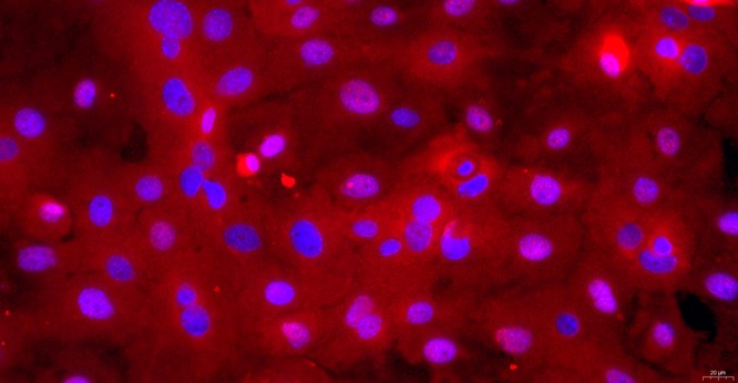 Primary Rabbit Lingual Epidermal Cells (LiEC)