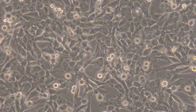 Human HS-5 Bone Marrow Stromal Cells (HS-5)