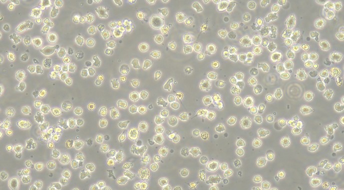 Human U266B1 Myeloma Cells (U266B1)