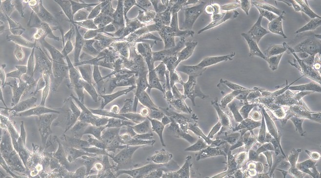 Human U-87MG Astroblastoma Cells (U-87MG)