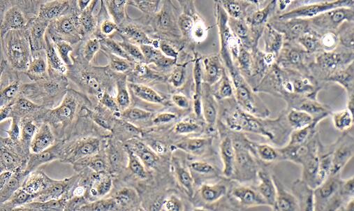 Human HK-2 Tubular Epithelial Cells (HK-2)