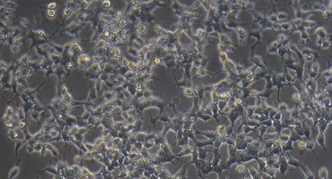 Human C666-1 Nasopharyngeal Carcinoma Cells (C666-1)
