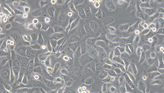 Human Nasal Epithelial Cells (NEPC)