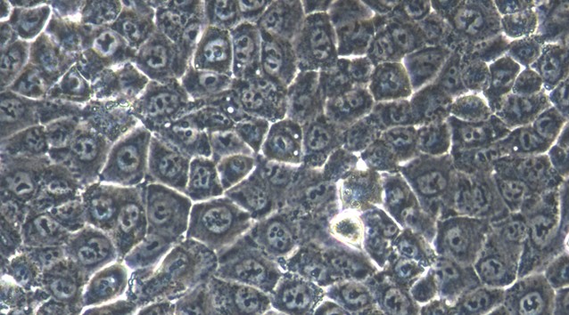 Human NCI-H460 Large-cell Lung Carcinomar Cells (NCI-H460)