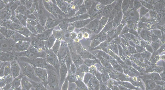 Human HGC-27 Gastric Cancer Cells (HGC-27)
