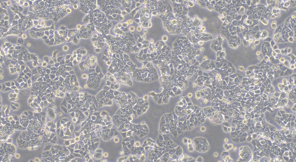 Human HT29 Colon Carcinoma Cells (HT29)
