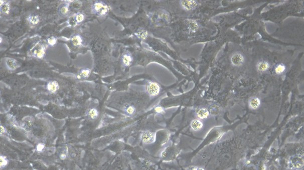Human U251 Glioblastoma Cells (U251)