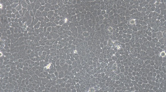 Human NCI-H292 Lung Carcinoma Cells (NCI-H292)