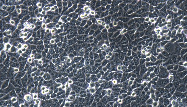 Human DLD-1 Colorectal Adenocarcinoma Epithelial cells (DLD-1 )