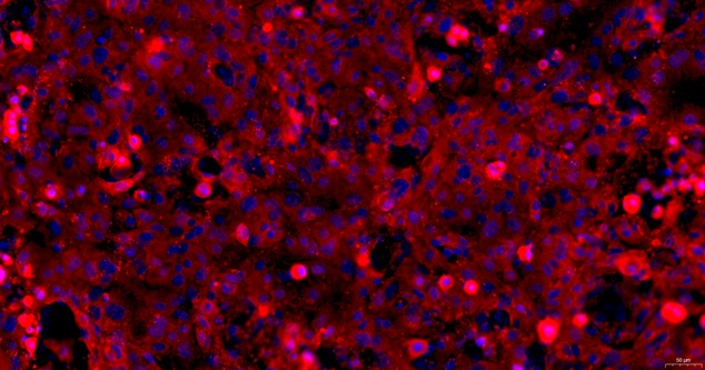Primary Mouse Oral Mucosal Epithelial Cells ( OMEC)