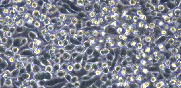 Human MKN45 Gastric Cancer Cells (MKN45)