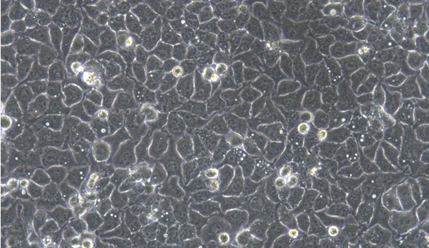 Human SACC-83 Salivary Gland Adenoid Cystic Carcinoma Cells (SACC-83)