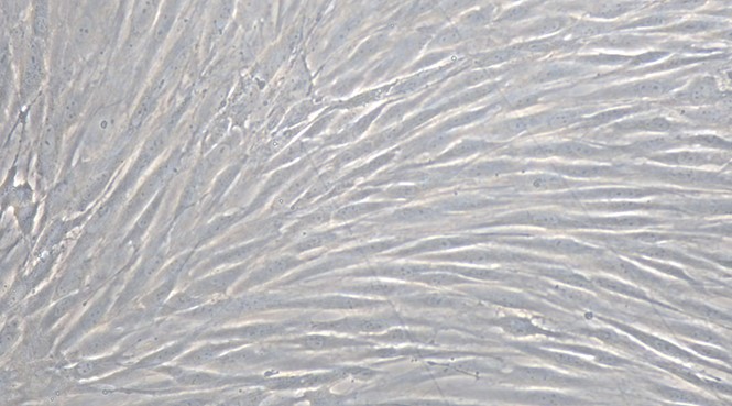 Primary Rat Cerebral Microvascular Smooth Muscle Cells ( CMSMC)