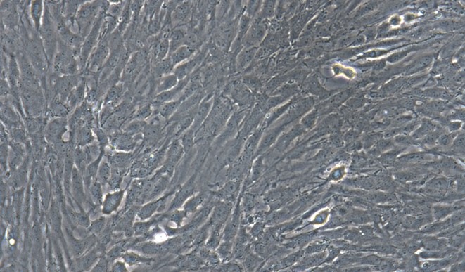 Primary Rat Tracheal Fibroblasts (TrF)