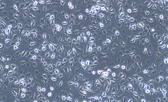 Primary Mouse Peritoneal Macrophage (PM)