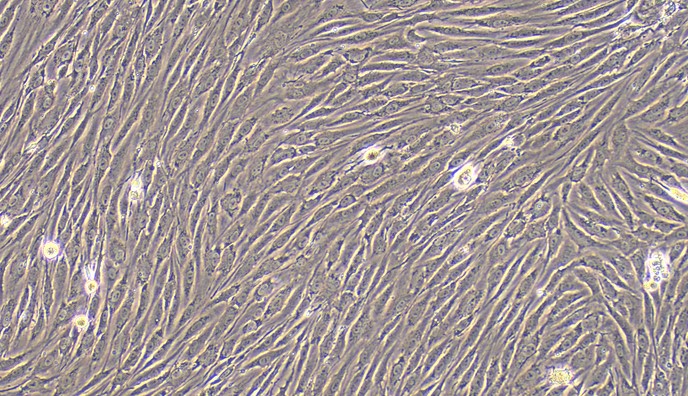Primary Rat Dermal Vascular Smooth Muscle Cells (DVSMC)