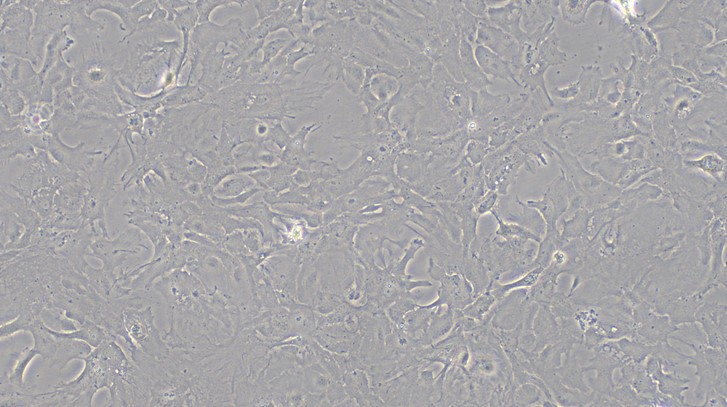 Primary Mouse Optic Nerve Astrocytes (ONA)