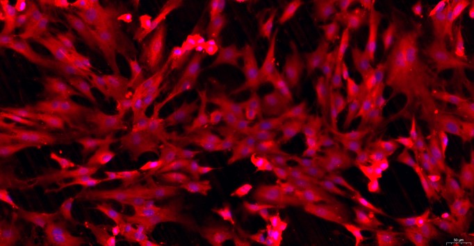 Primary Rat Ovarian Interstitial Cells (OIC)