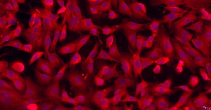 Primary Mouse Peritoneal Fibroblasts (PF)