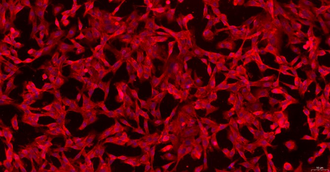 Primary Mouse Peritoneal Fibroblasts (PF)