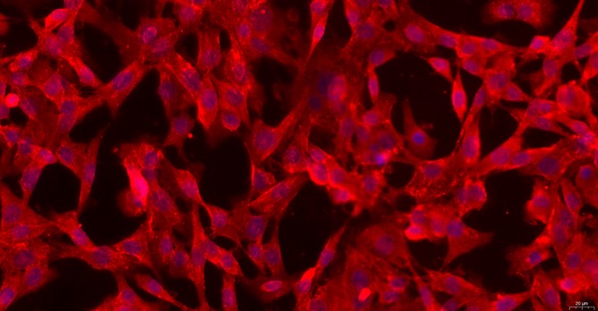 Primary Mouse Peritoneal Fibroblasts (PF)