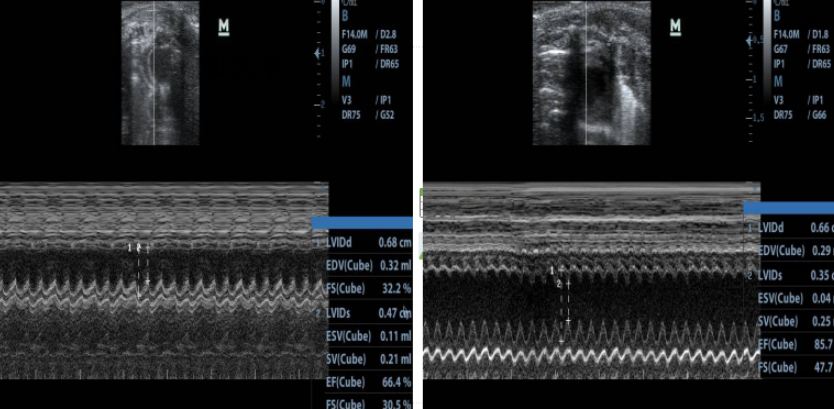 Rat Model for Myocardial Infarction (MI)