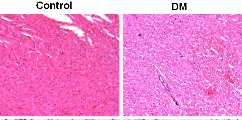 Rat Model for Diabetes Mellitus (DM)