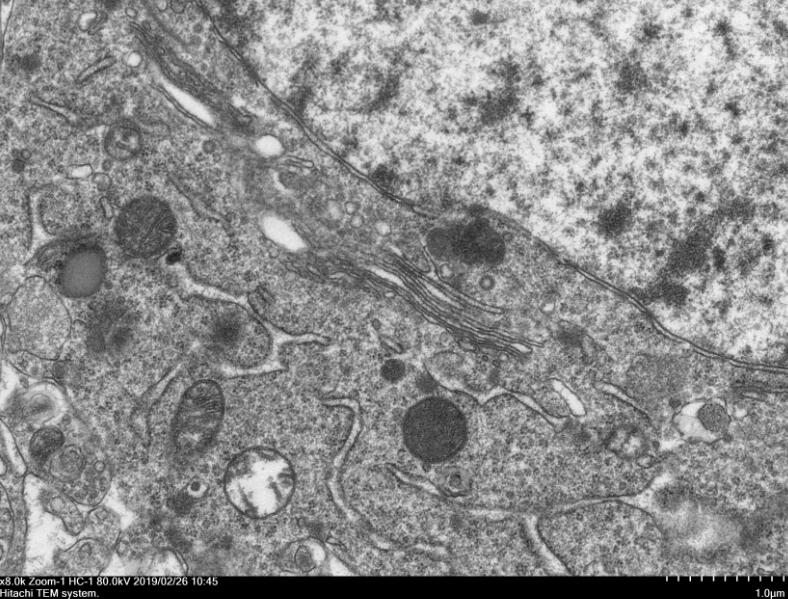 Mouse Model for Parkinson's Disease (PD)