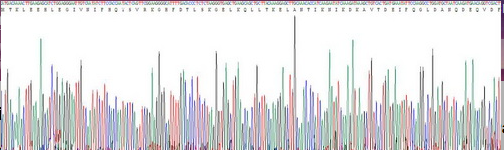Eukaryotic S100 Calcium Binding Protein A12 (S100A12)