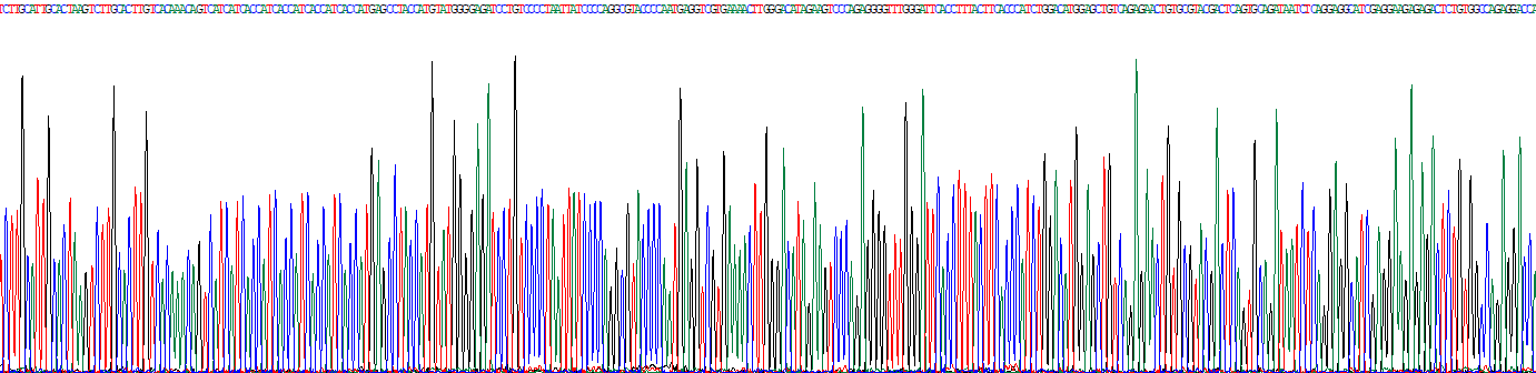 Eukaryotic Complement Component 1, S Subcomponent (C1s)