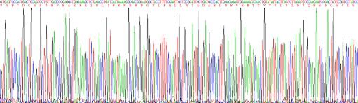 Eukaryotic Histidine Rich Glycoprotein (HRG)