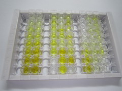 High Sensitive ELISA Kit for Nitric Oxide Synthase 2, Inducible (NOS2)