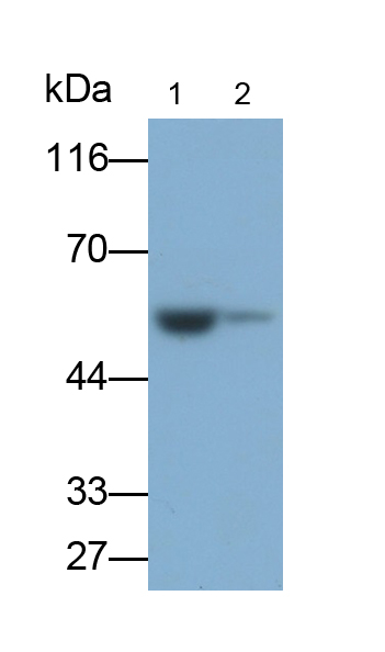 Labelled Polyclonal Antibody to Cytokeratin 7 (CK7)