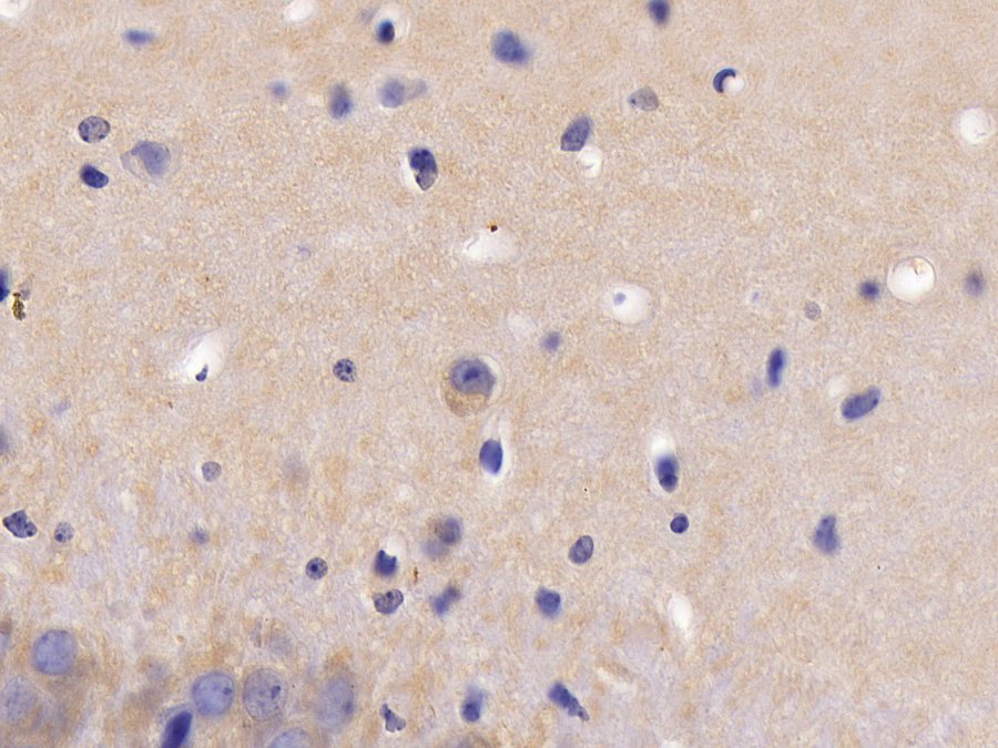 Biotin-Linked Polyclonal Antibody to Tumor Necrosis Factor Receptor 1 (TNFR1)