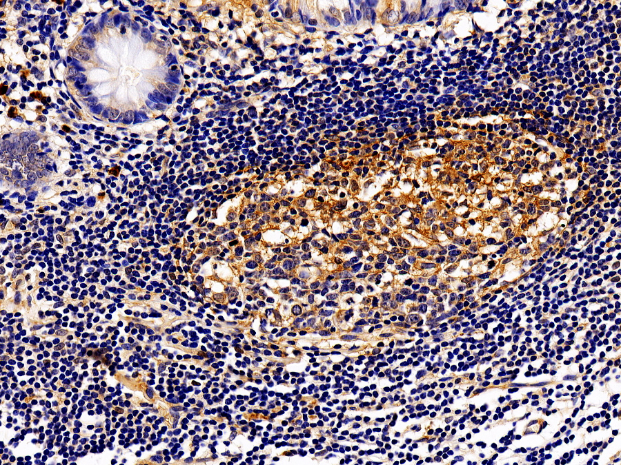 Biotin-Linked Polyclonal Antibody to Interleukin 13 Receptor Alpha 1 (IL13Ra1)