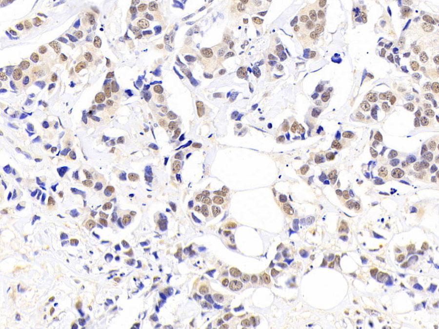 Biotin-Linked Polyclonal Antibody to Nucleophosmin 1 (NPM1)