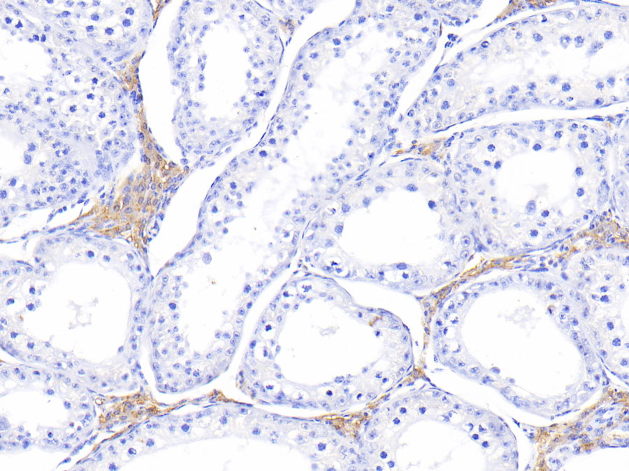 Biotin-Linked Polyclonal Antibody to Melatonin Receptor 1A (MTNR1A)
