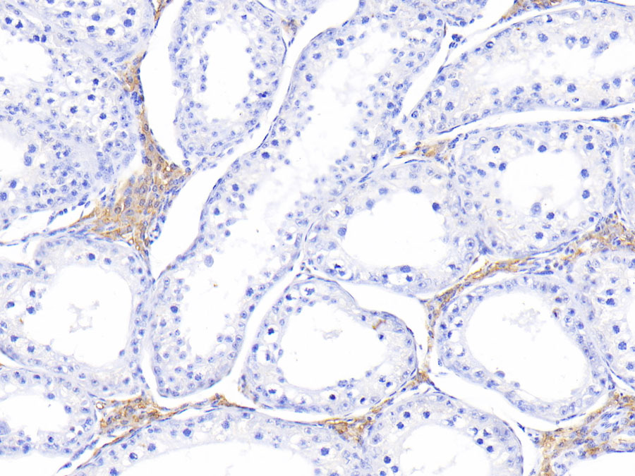 Biotin-Linked Polyclonal Antibody to Melatonin Receptor 1A (MTNR1A)