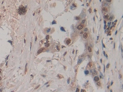 Monoclonal Antibody to Amphiregulin (AREG)