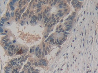 Monoclonal Antibody to Amphiregulin (AREG)