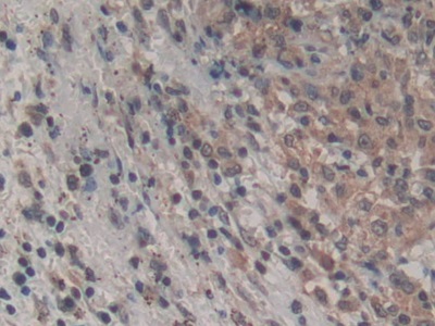 Monoclonal Antibody to Amphiregulin (AREG)